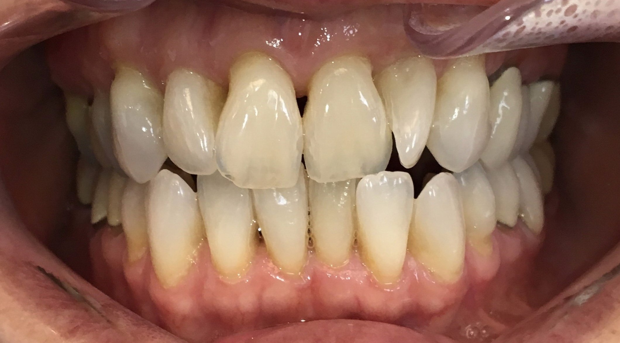 case 2 before