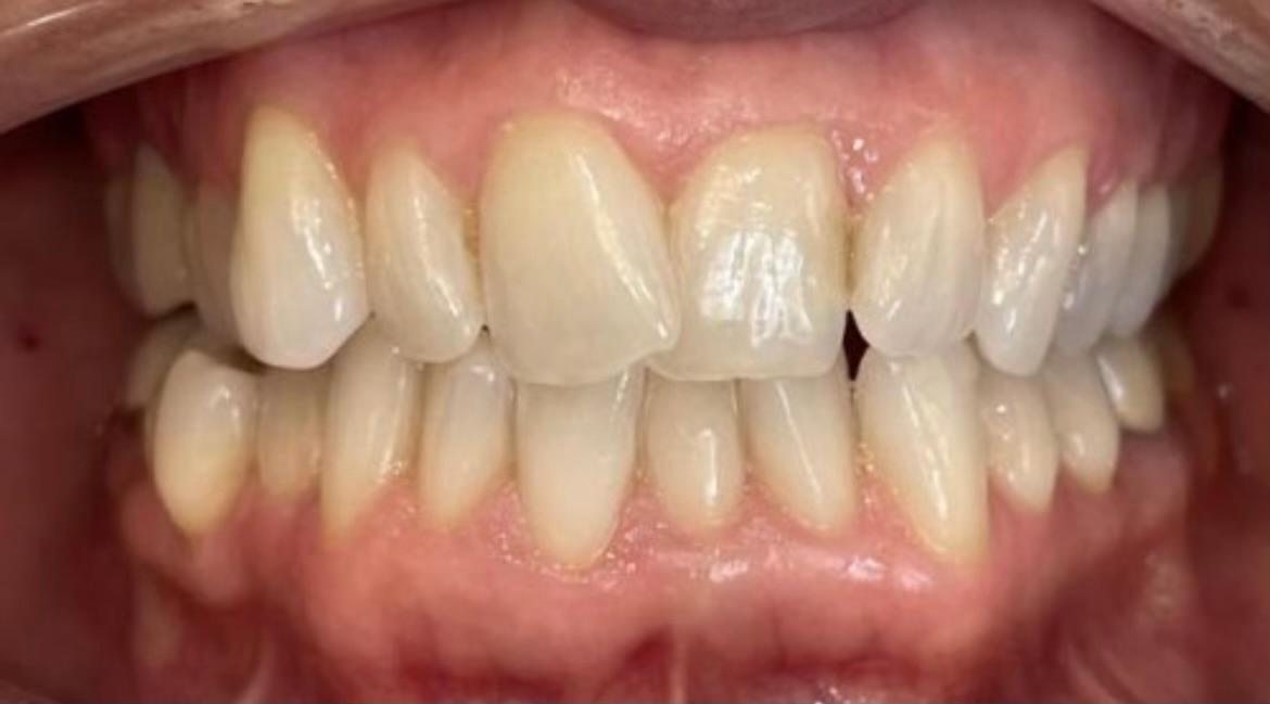 case 4 before
