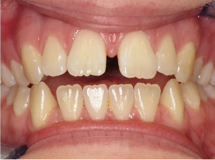 case 1 before